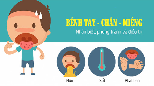 Bệnh tay chân miệng là gì? Cách phòng bệnh tay chân miệng ở trẻ nhỏ