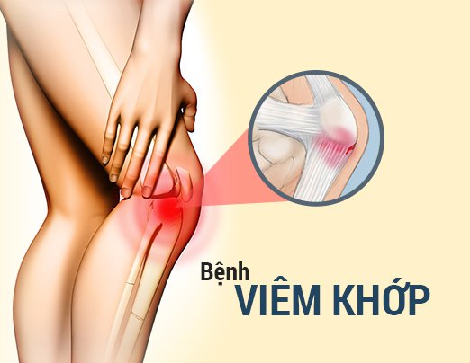 Viêm khớp và đau khớp